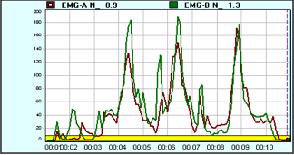 Green peak (extensors), Red peak (flexors) during hockey 3 slap shots